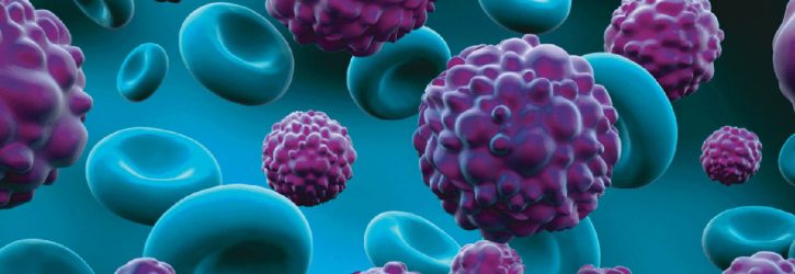 Cancer Misdiagnosis Claims