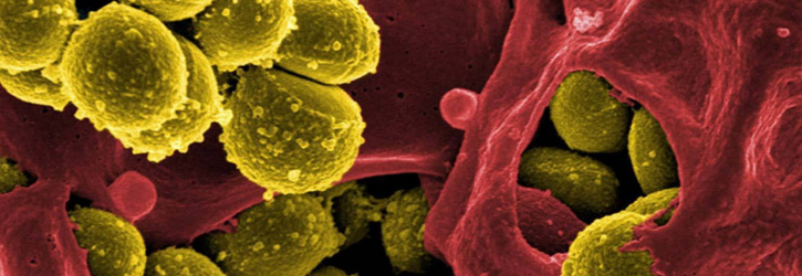 Hospital Acquired Infection Claim
